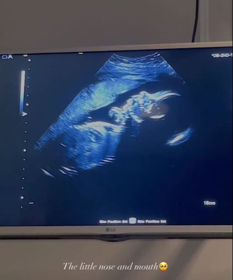 Molly-Mae Hague shared a sweet clip of her baby scan