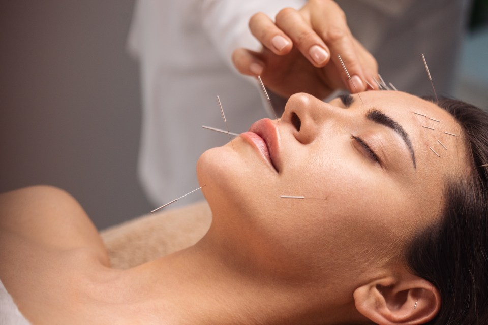 Acupuncture can be effective - but it's very pricey