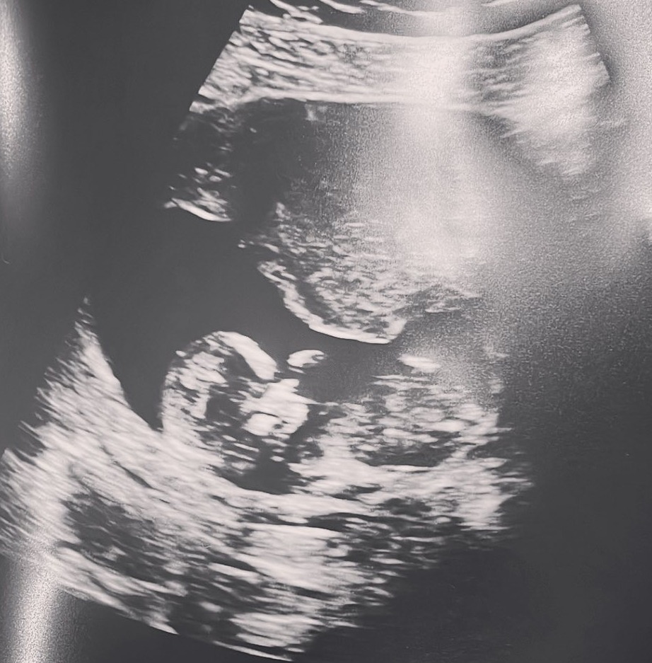 Daisy shared her baby scan with fans