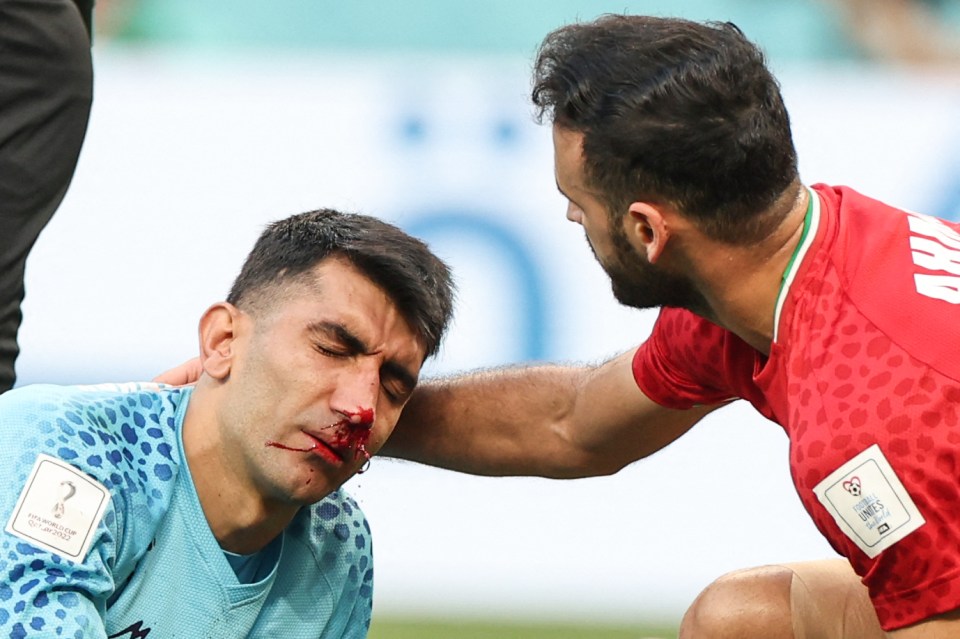 Iran goalkeeper Alireza Beiranvand suffered a bloody nose