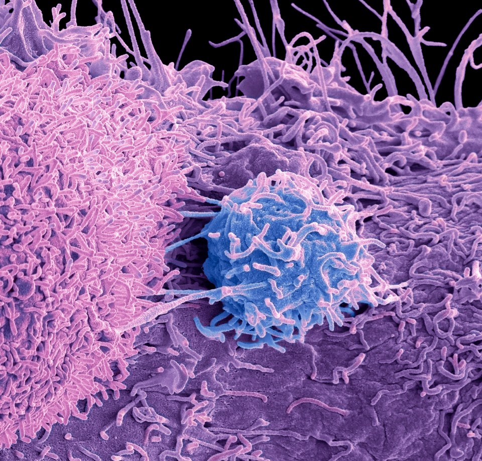 52,000 Brits are diagnosed with prostate cancer annually and more than 12,000 die each year