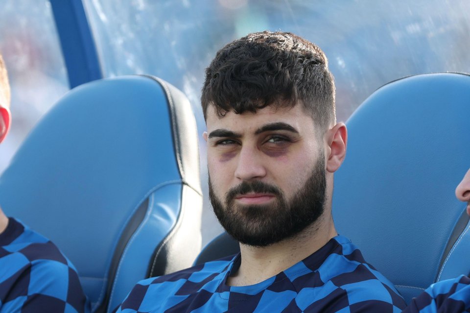 Gvardiol was sporting two black eyes when he was on the bench for Croatia's World Cup warm-up match recently