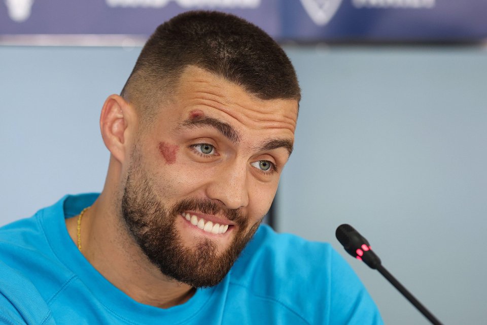 Mateo Kovacic had nasty looking cuts on his face