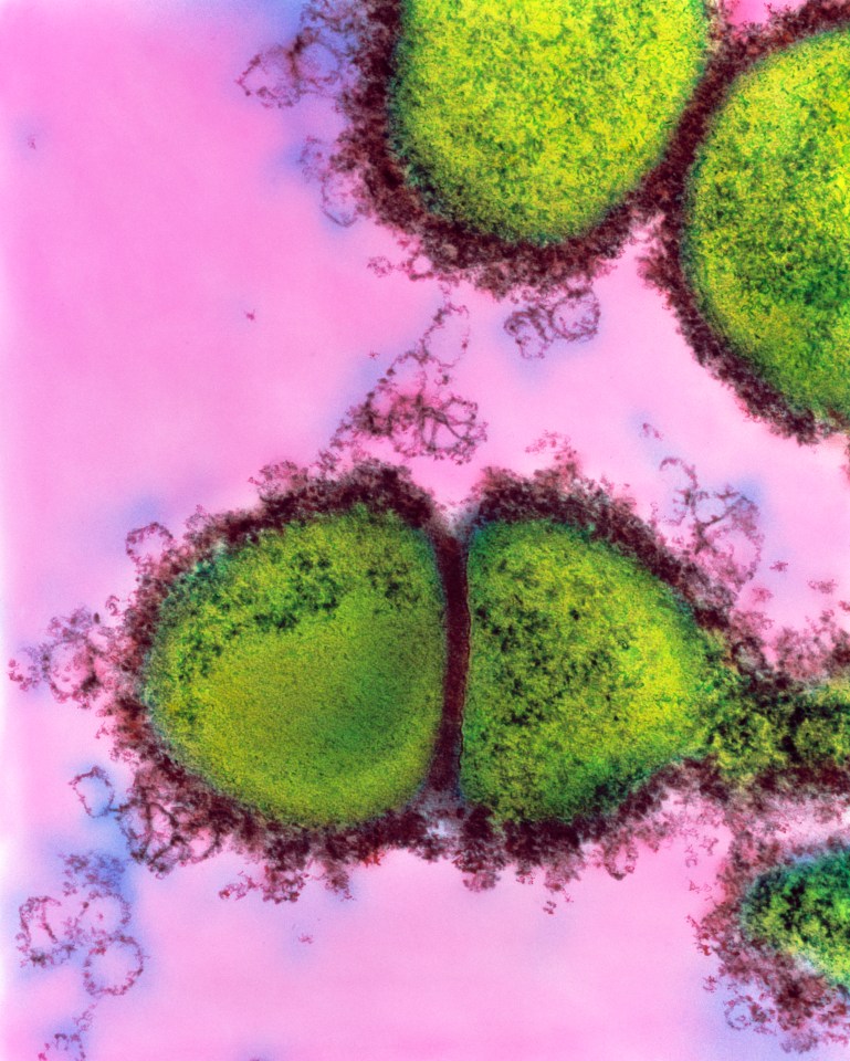 The Streptococcus pyogenes bacteria can cause a range of skin and throat infections