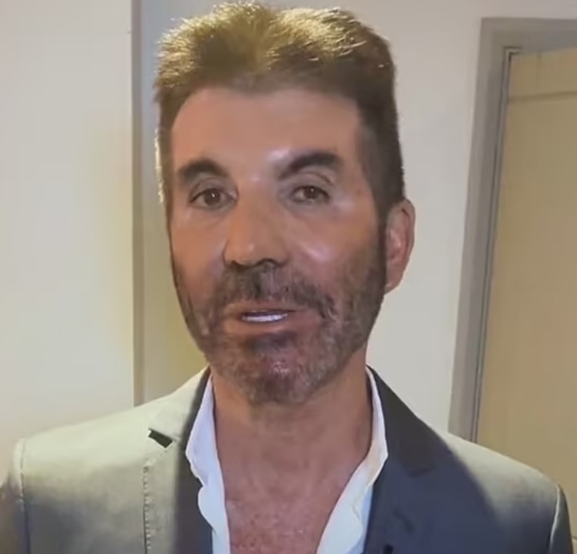 Simon Cowell fans have questioned whether he has had cosmetic surgery or not