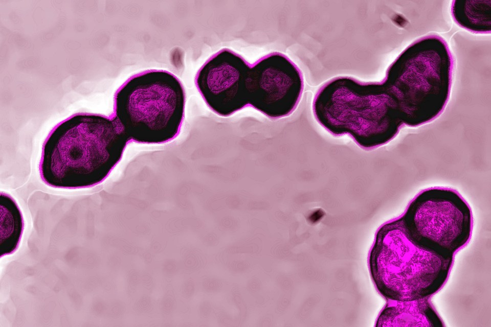 Cases of Strep A have risen across the UK, so too have more serious cases of both scarlet fever and invasive Group A Strep disease