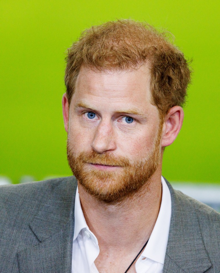 The Duke of Sussex joked he needed 'electric shock therapy' to remove the images from his brain