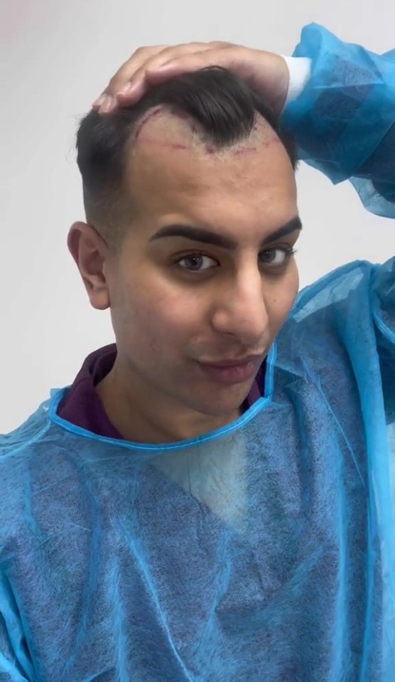 Towie's Junaid Ahmed had his hair shaved before the procedure