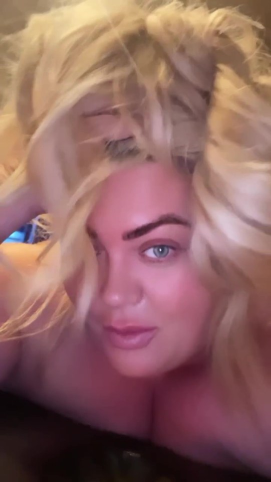 Gemma Collins has turned to cupping to help treat a mystery illness