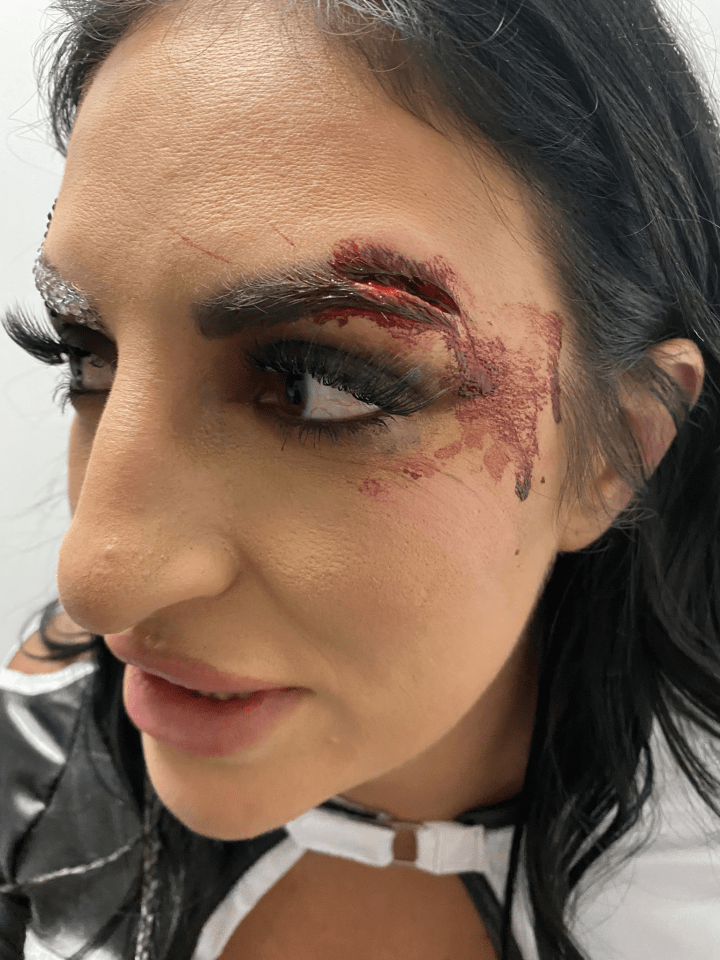 The grappler shared this photo of a nasty gash above her eye via Twitter