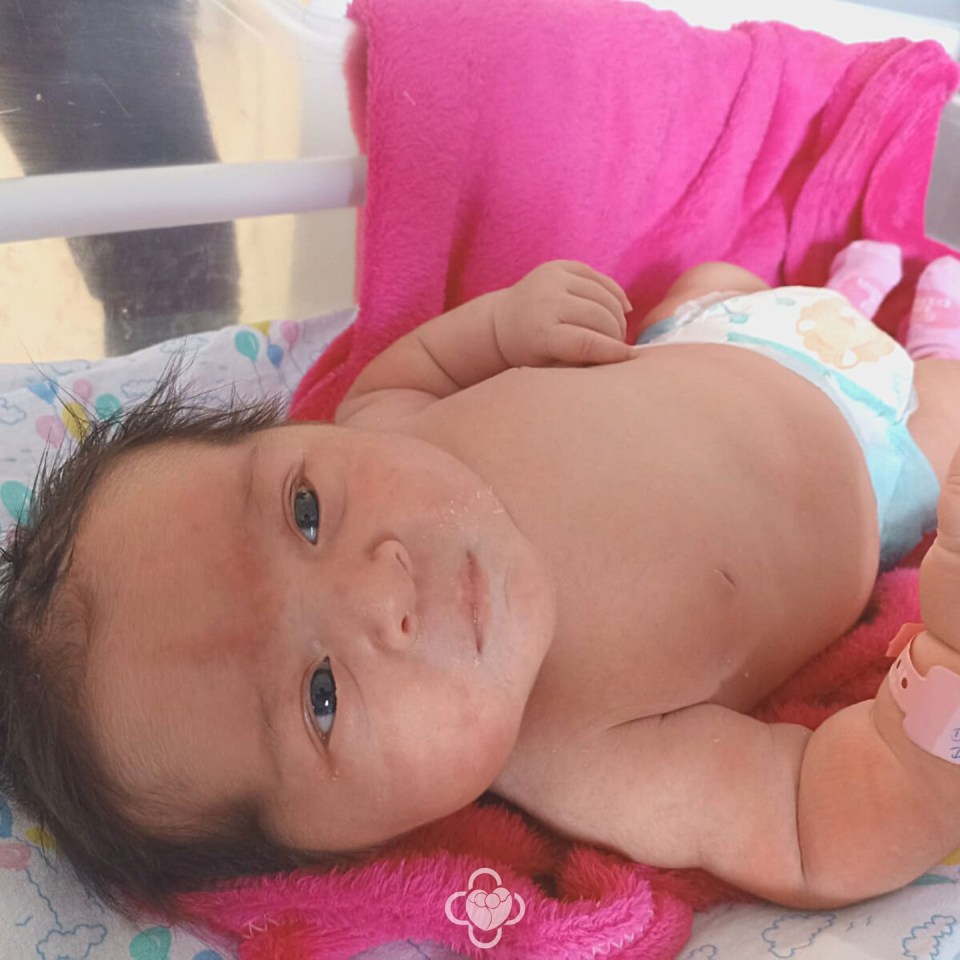 The baby girl stunned doctors by her size