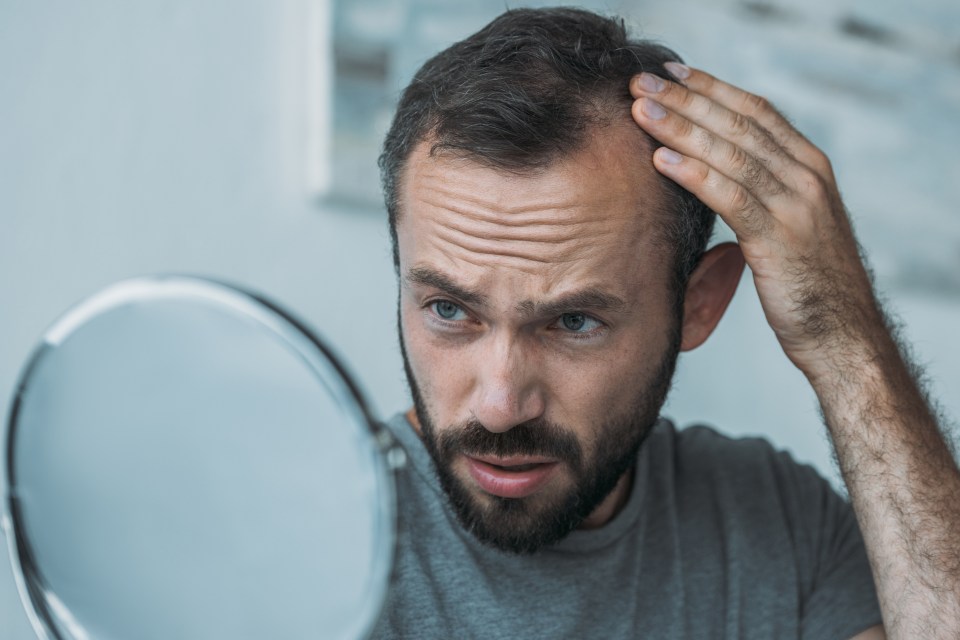 Experts found that men who drink sweetened drinks are more likely to experience hair loss