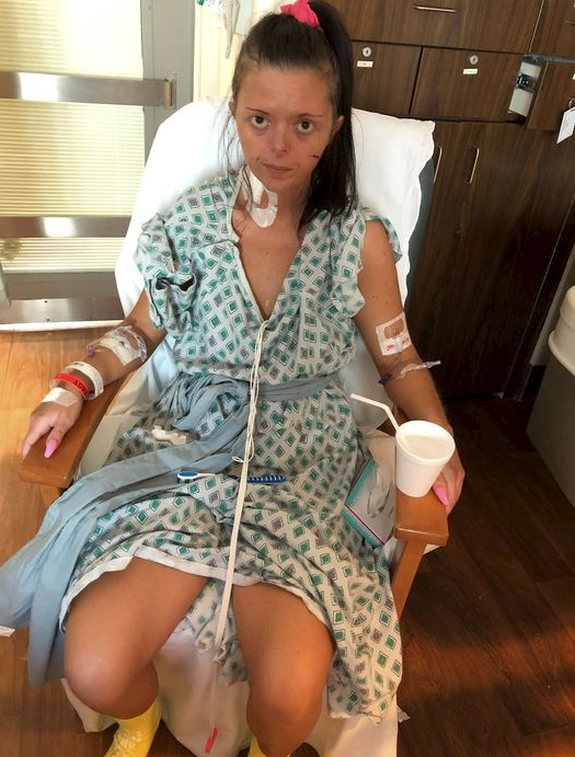 Medics in the US put her condition down to her vaping, something she had been doing for around seven years