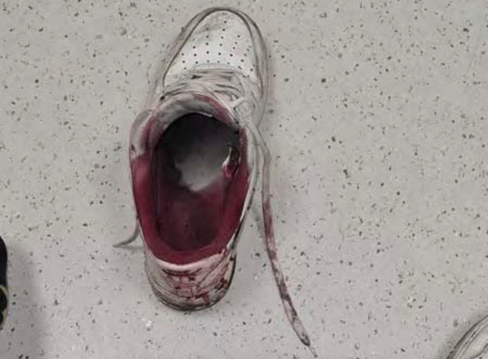 Her shoe covered in blood following the gruesome attack