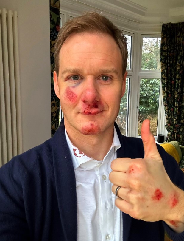 Dan Walker has revealed he's eating solid food again after his bike accident