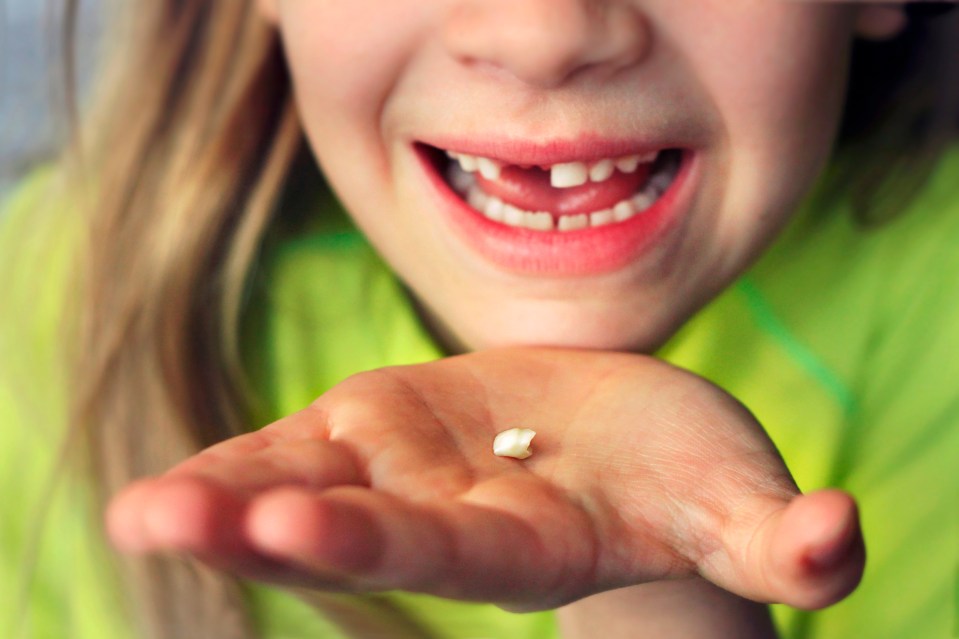 Some claim that it’s the cost-of- living crisis that’s causing kids’ teeth to fall out