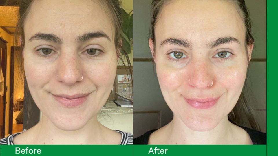 Results from using Skin Filter supplements