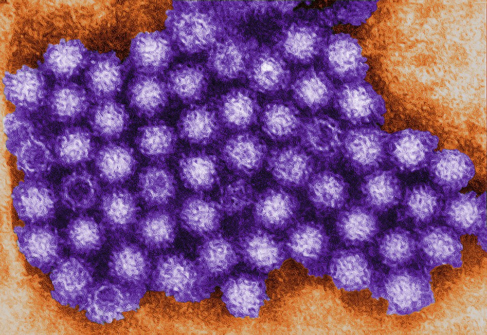 Norovirus (pictured) cases are nearly twice as high as normal, UK Health Security Agency figures show