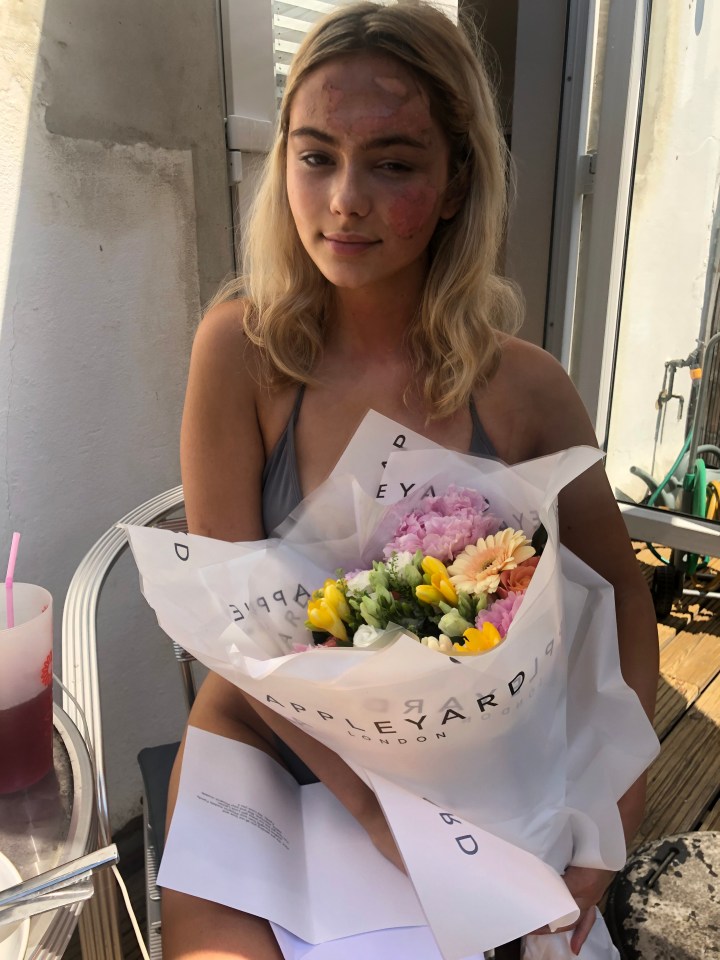 ASOS sent Alice flowers and told her they would continue to work with her after her horror accident