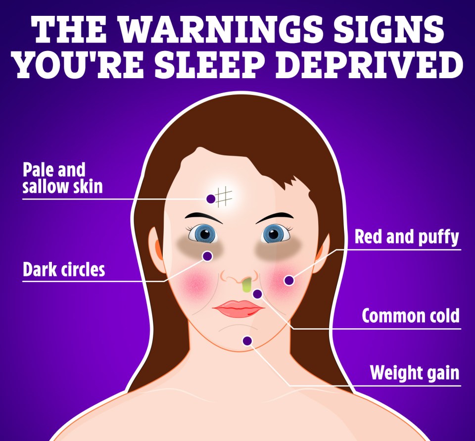 If you're not getting enough sleep, there are physical warning signs that you might be able to spot