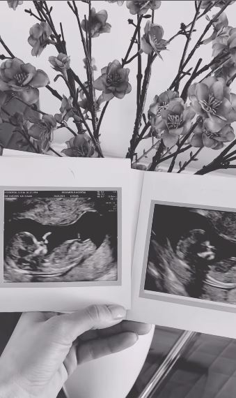 The star revealed the news in a video and showed off baby scans