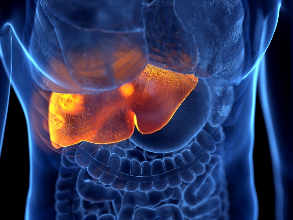 Symptoms of liver cancer include loss of appetite, unexpected weight loss, vomiting blood, and pain or swelling of the abdomen