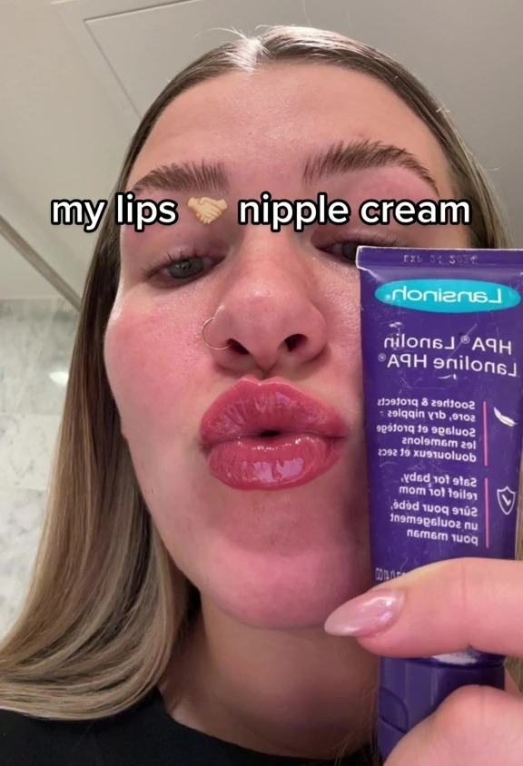 Esther Burden uses nipple cream to hydrate her pout