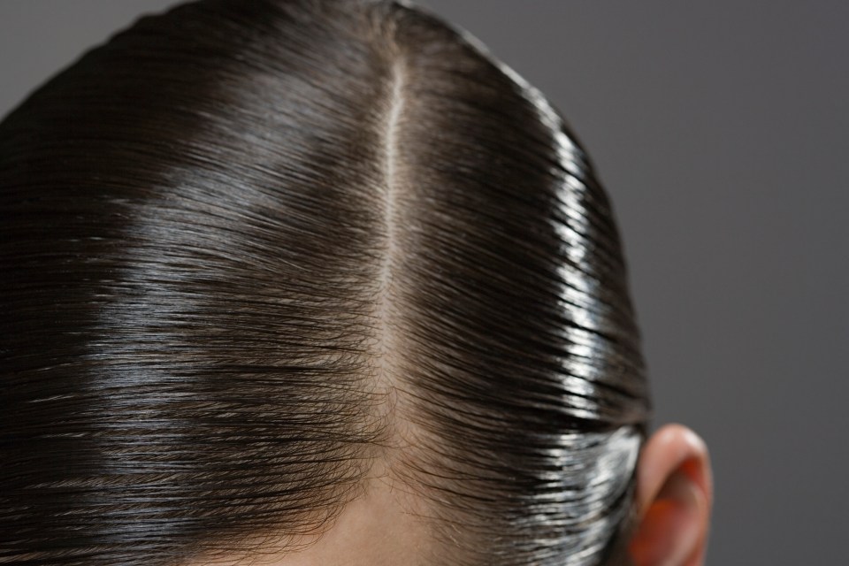 Thinning and shedding of hair can be down to the body depleting its nutrient stores