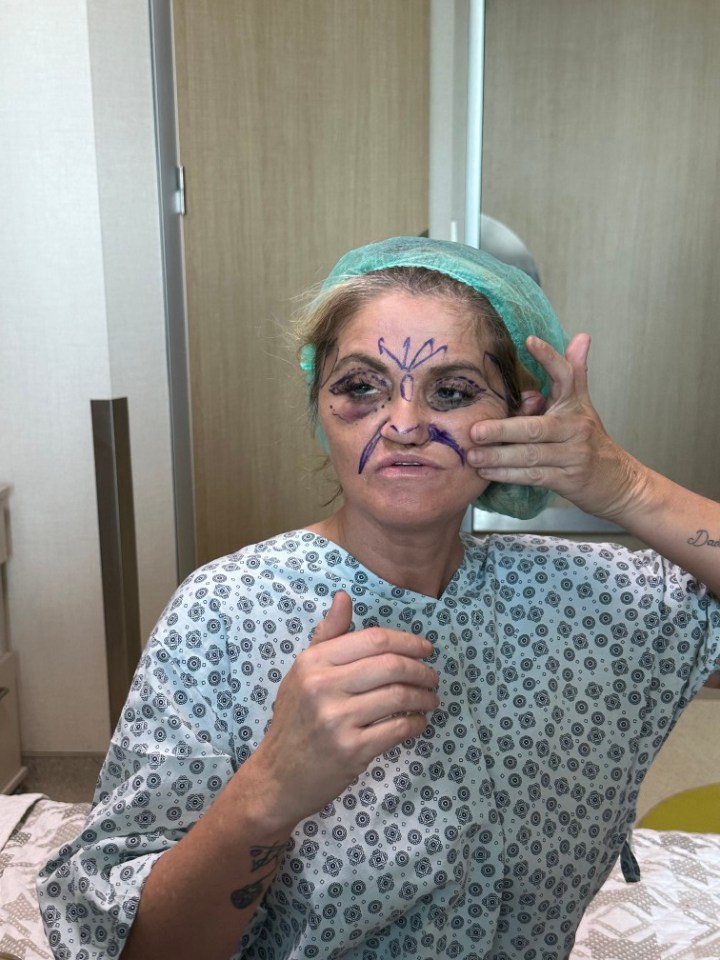 Danniella flew to Turkey this week to have the final round of facial reconstruction surgery