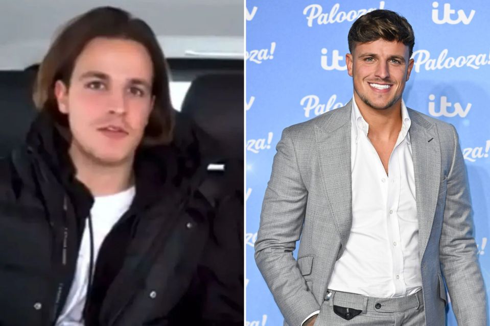 Luca Bish went to Turkey to get his veneers before Love Island