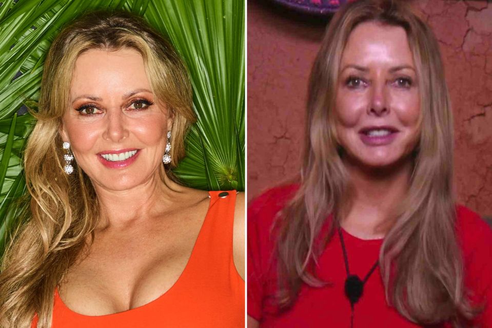 Carol Vorderman has admitted Botox is the secret to her looking young