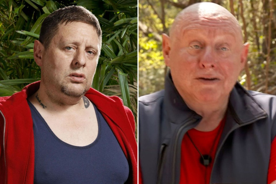 Shaun Ryder has had ‘skin pigmentation’ eyebrows after his hair fell out due to alopecia