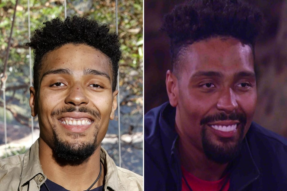 Jordan Banjo has got new veneers