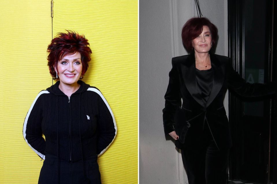 Sharon Osbourne before and after