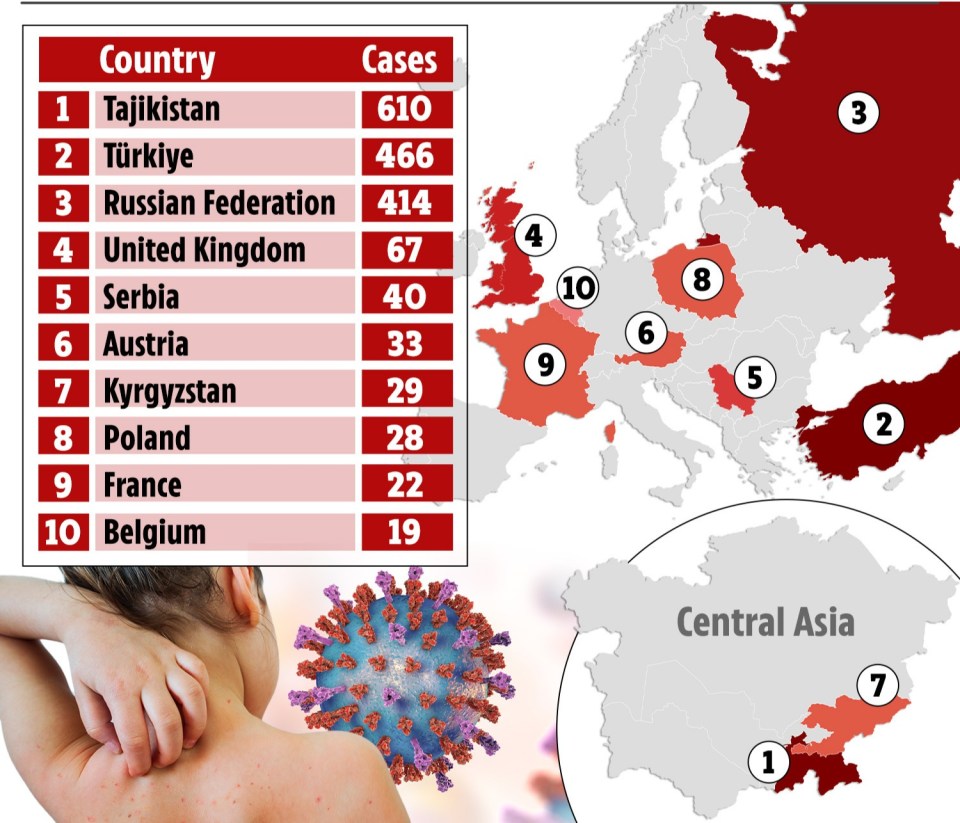 Measles outbreaks have been reported in 17 countries in the WHO European region - these are 10 with the most cases according to WHO