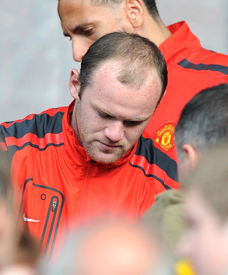 Dr Victor Hasson says Rooney removed the stigma by going public after his 2011 treatment