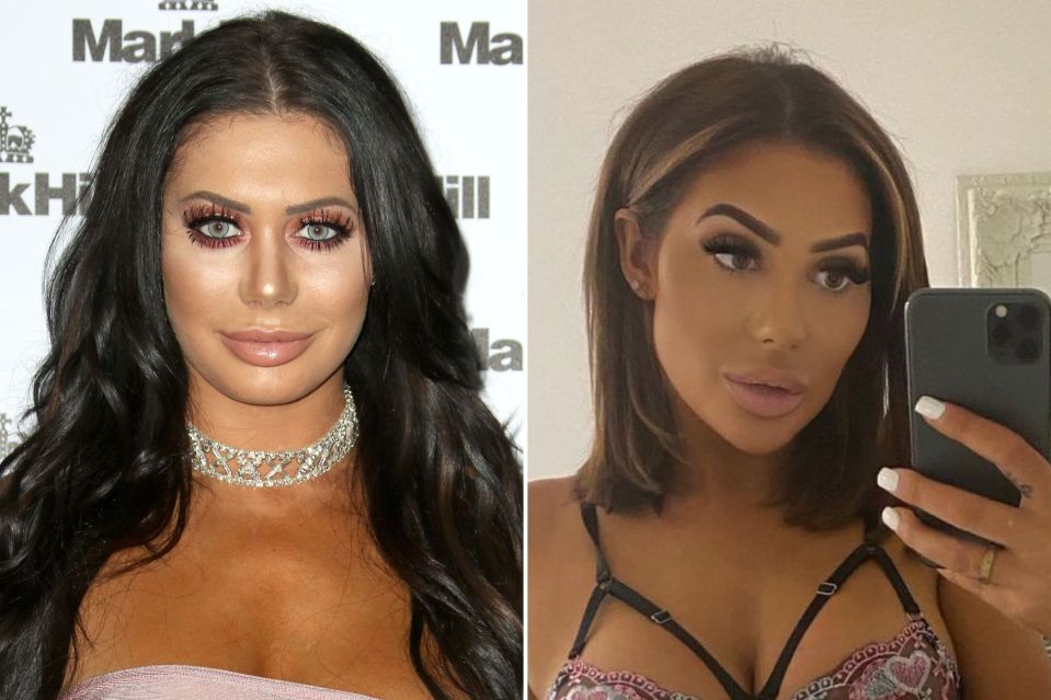 Chloe Ferry admitted that she loves surgery