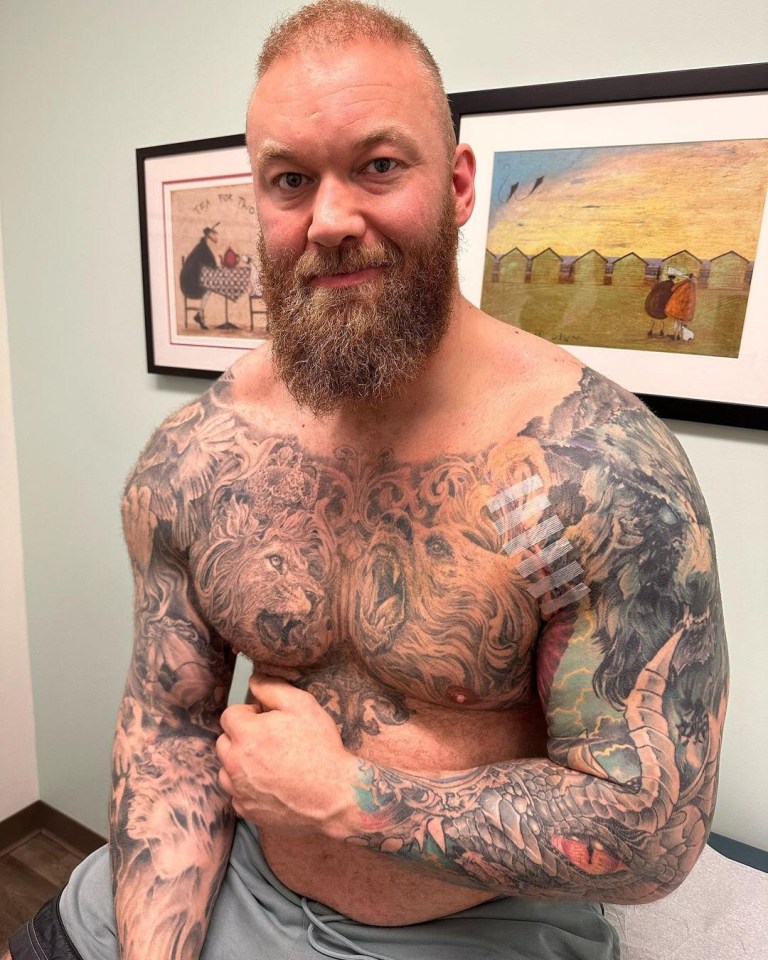 Bjornsson is in good spirits following his surgery and has kept fans updated