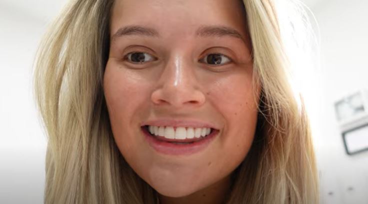 Molly-Mae Hague has shown off her new smile