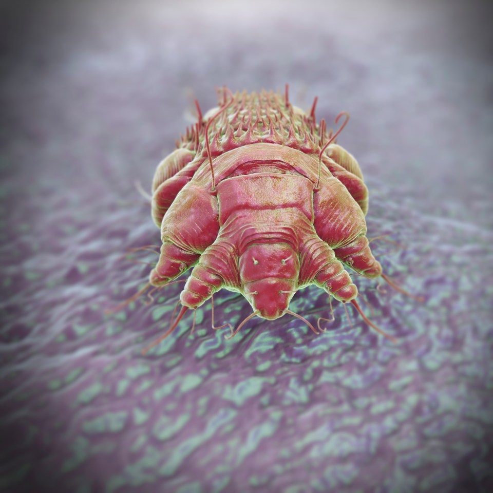 A Sarcoptes scabiei mite, the cause of the contagious skin infection Scabies