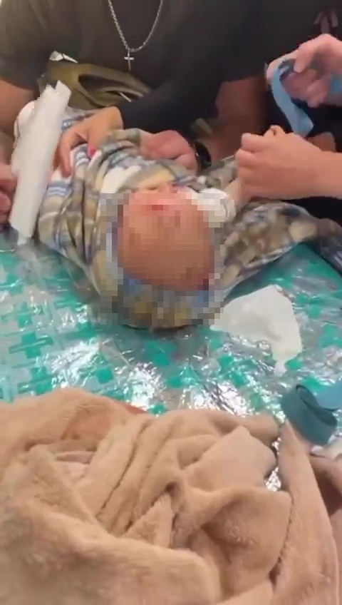 First responders bandaged the injured infant