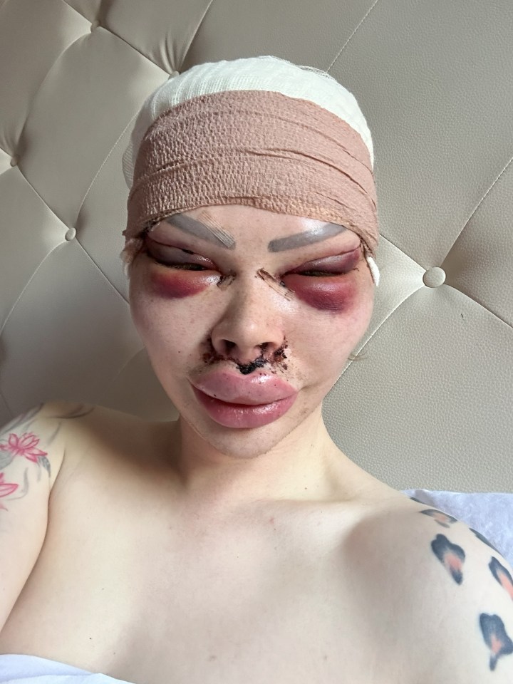 Shocking images showed the aftermath of his five-hour surgery