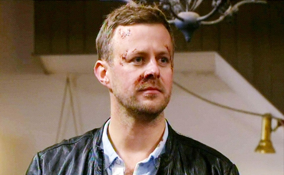 Fans were in shock to see Emmerdale villain, Carl King played by actor Tom Lister back on their screens 12 years after his brutal soap exit