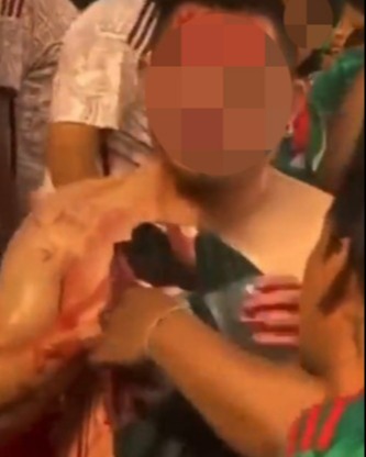 A man was stabbed in the chest during a Mexico vs Qatar football match