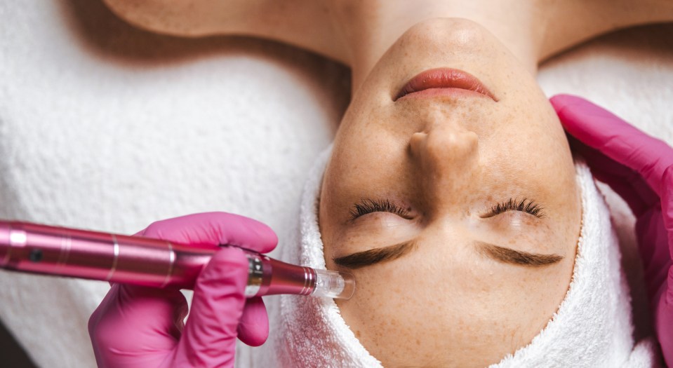 During microneedling a needle is used to make tiny holes in the top layer of the skin.