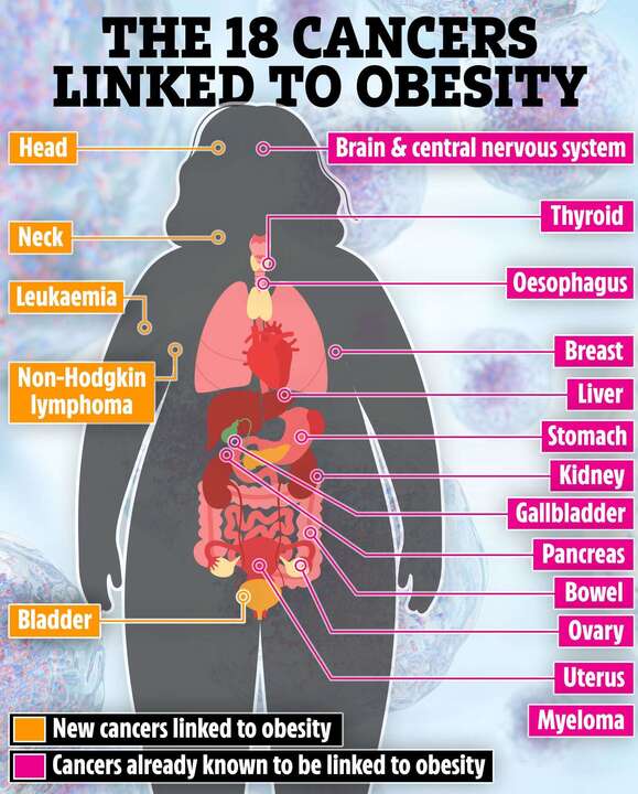 The 18 cancers linked to obesity