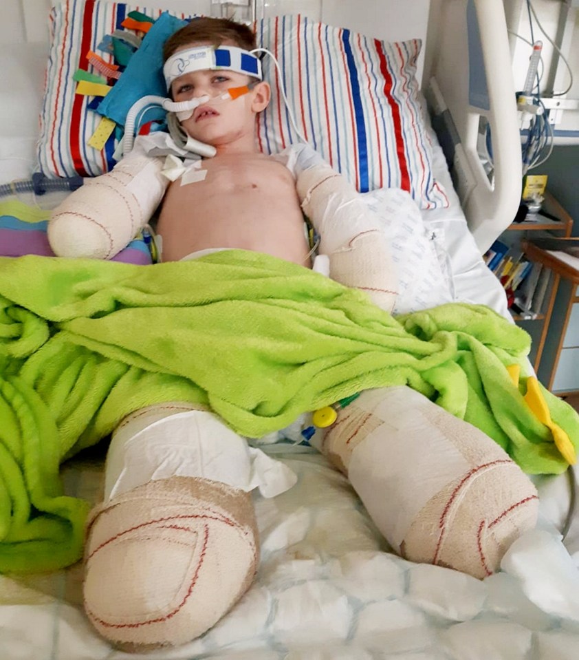 Luke was rushed to hospital when he was seven with meningitis and sepsis, which spread to his limbs