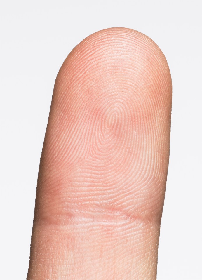 Enlarged or swollen finger tips could be a sign that you might need to go to the doctors