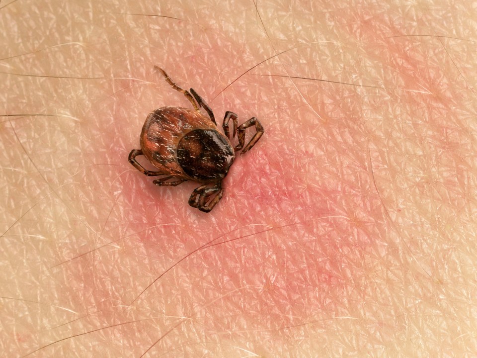 If you spot a tick attached to your skin, remove it