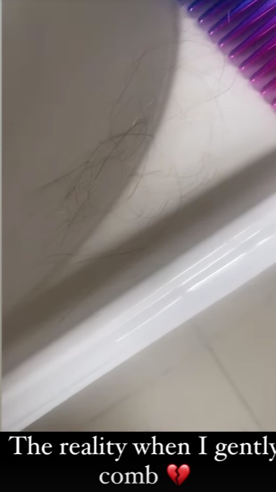 Amy shared a video of her hair in a sink after combing it 'gently'